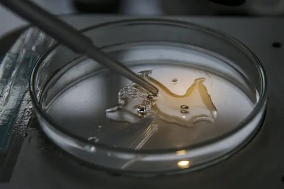 Tubo de ensaio em laboratório com pipeta sobre líquido amarelo.
